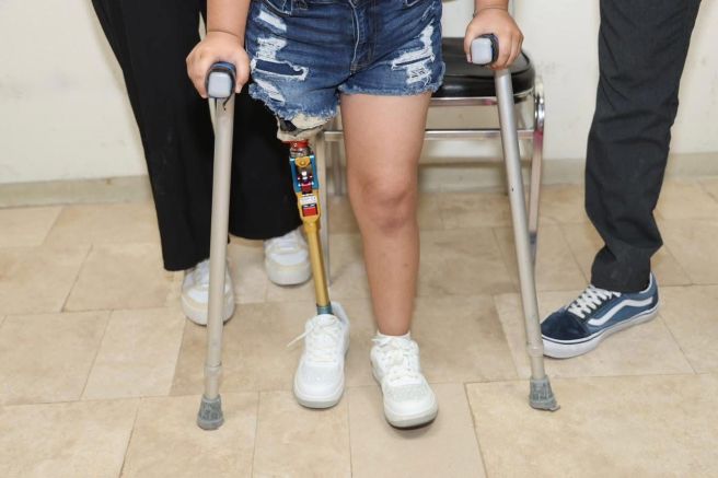 DIF ESTATAL ENTREGA PRÓTESIS A PEQUEÑA DE 7&nbsp;AÑOS